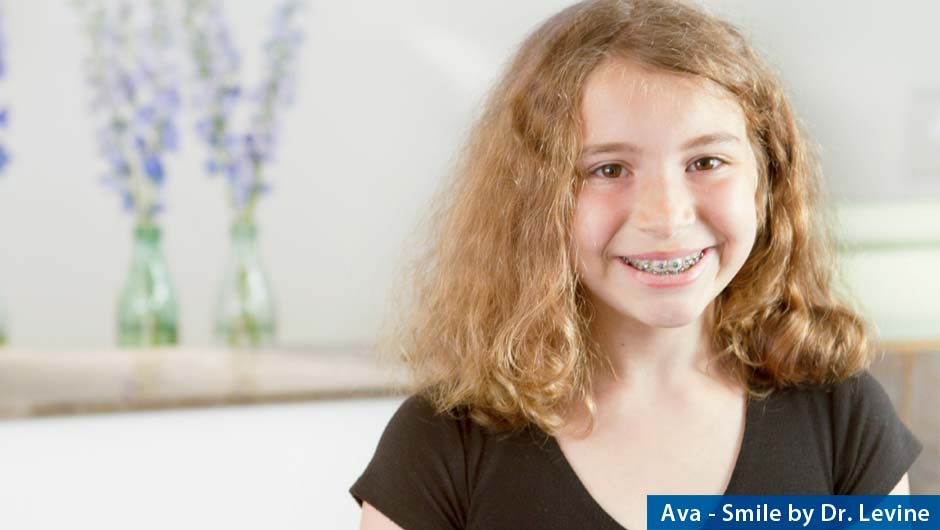 damon-braces_orthodontist-dr-levine-3266a